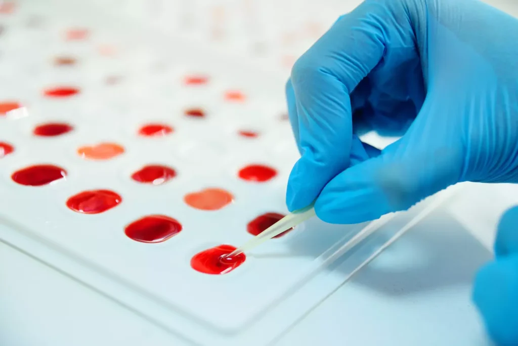 Indications for Blood Platelet Infusion