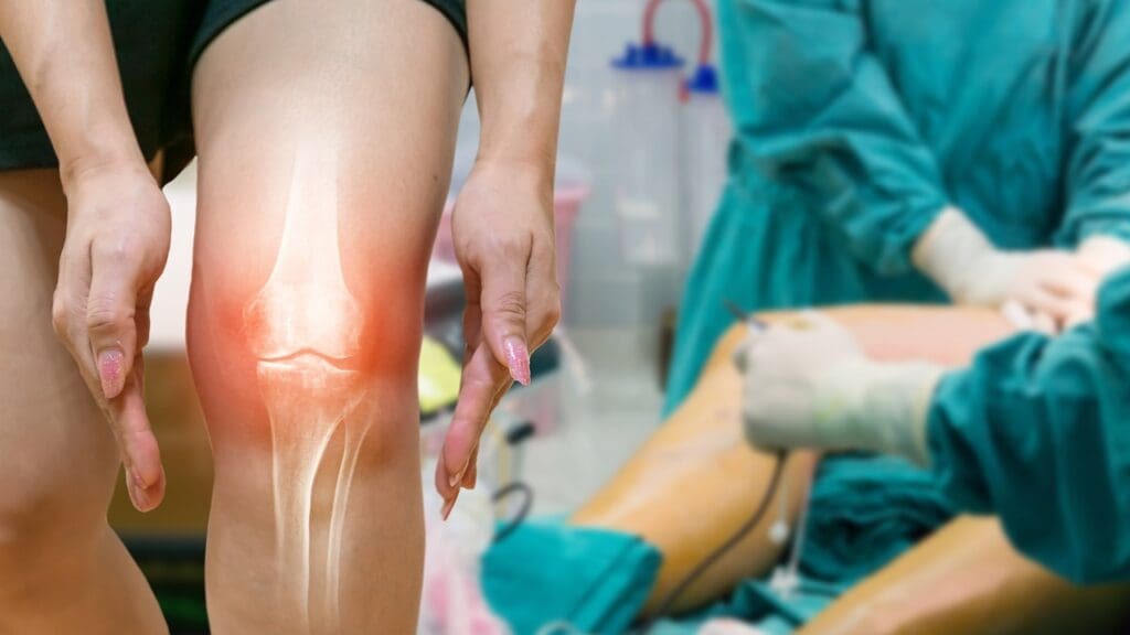 Knee Arthroscopy