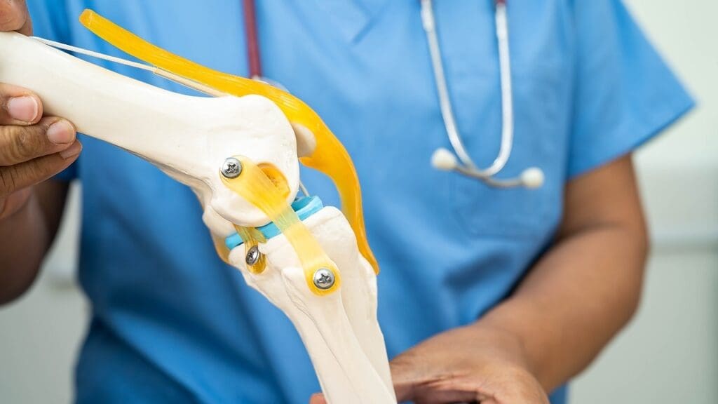 Knee Arthroscopy Surgery