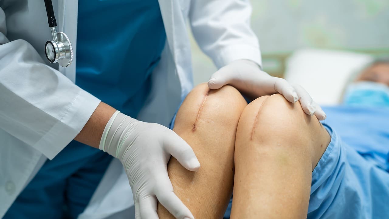 Knee Arthroscopy