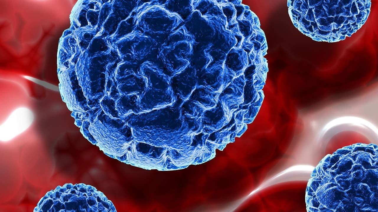 Large B-Cell Lymphoma