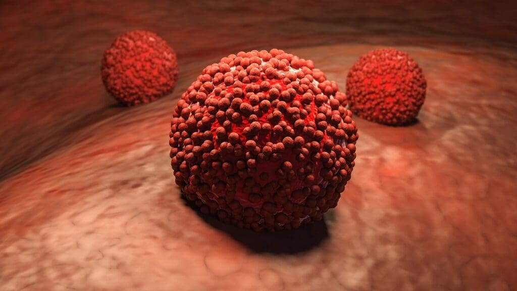 Malignant Spinal Tumor Prognosis