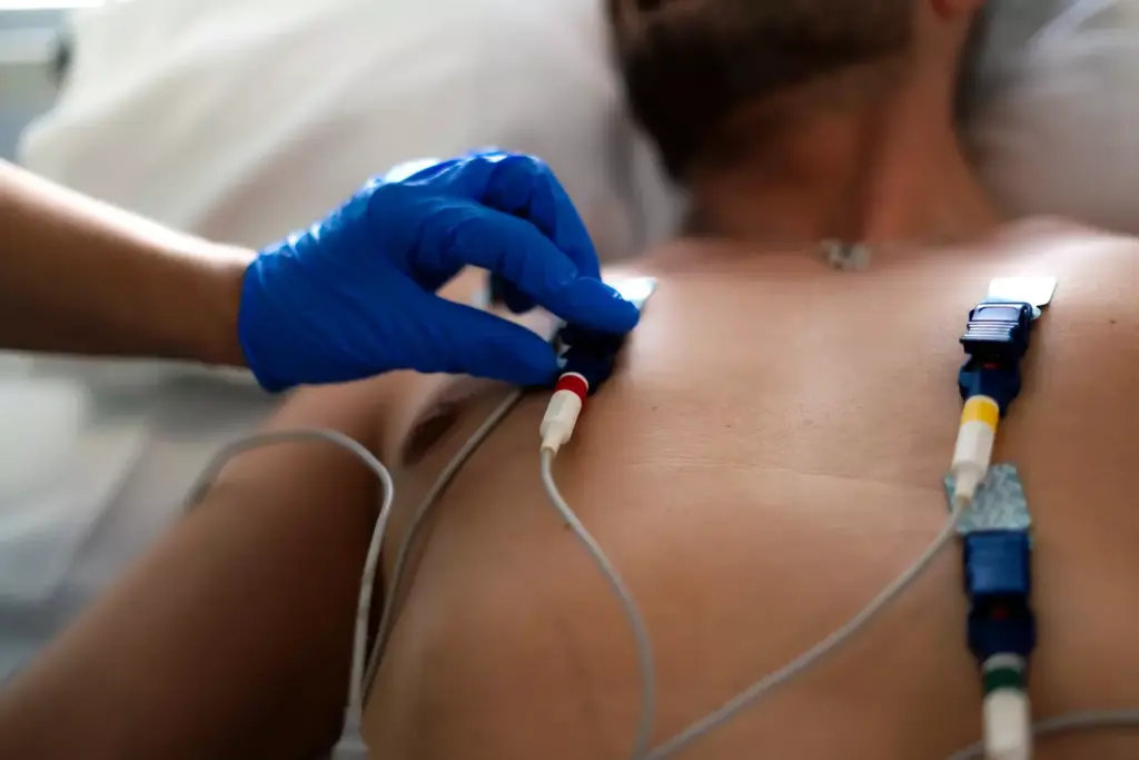 Paroxysmal Atrial Fibrillation Affects Heart Function