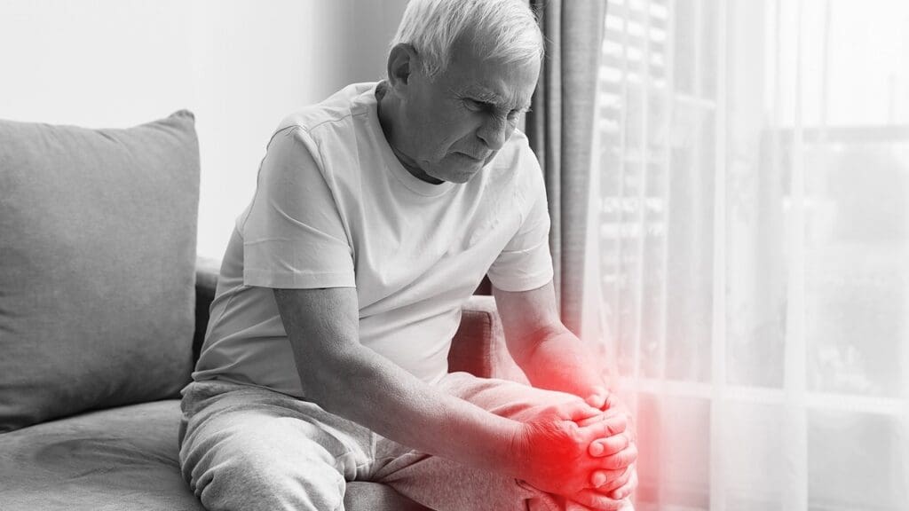 Patellofemoral Arthritis