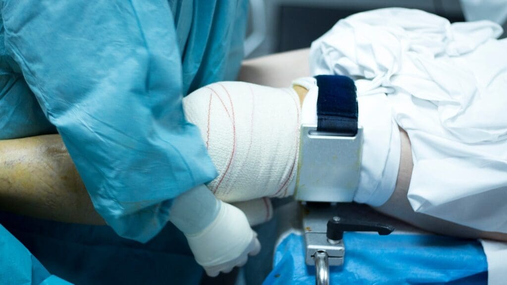 Recover from ACL Tear Arthroscopic Surgery