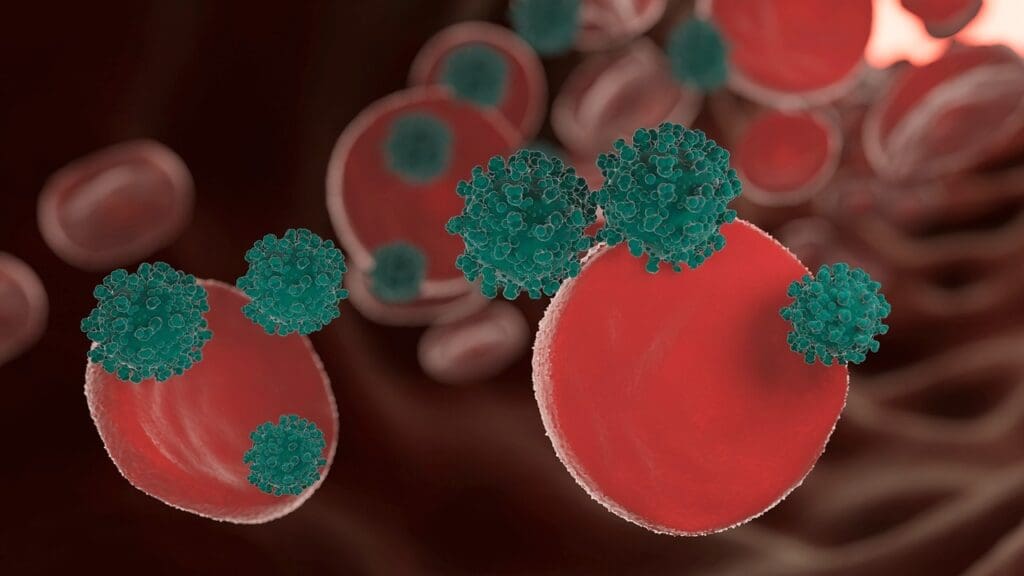 Stage 4 Diffuse B Cell Lymphoma