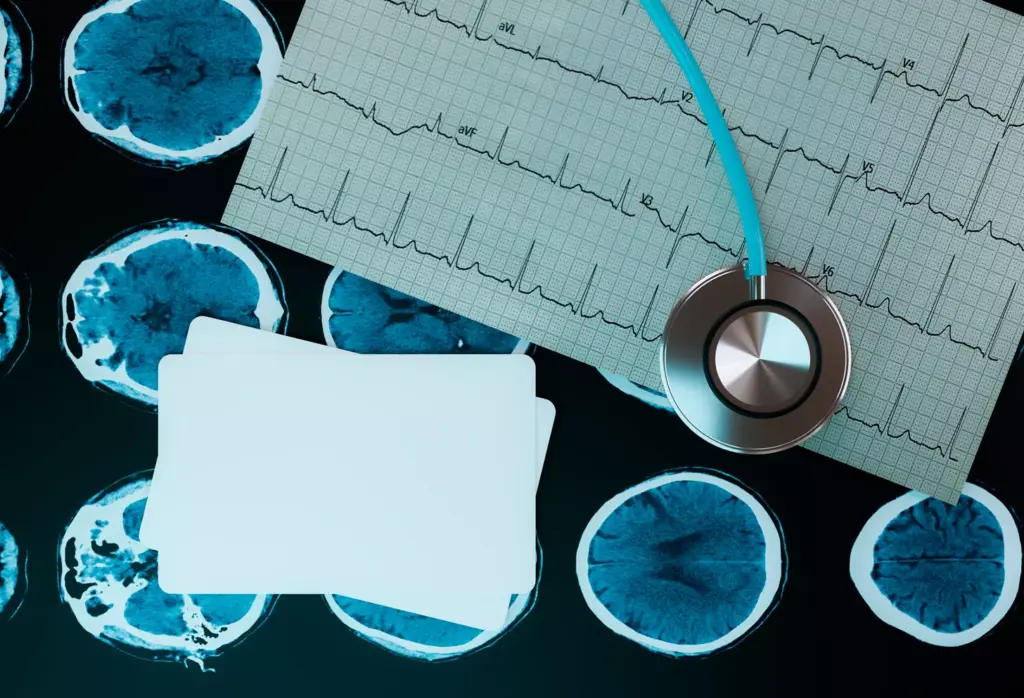 The Basics of Heart Rhythm Monitoring