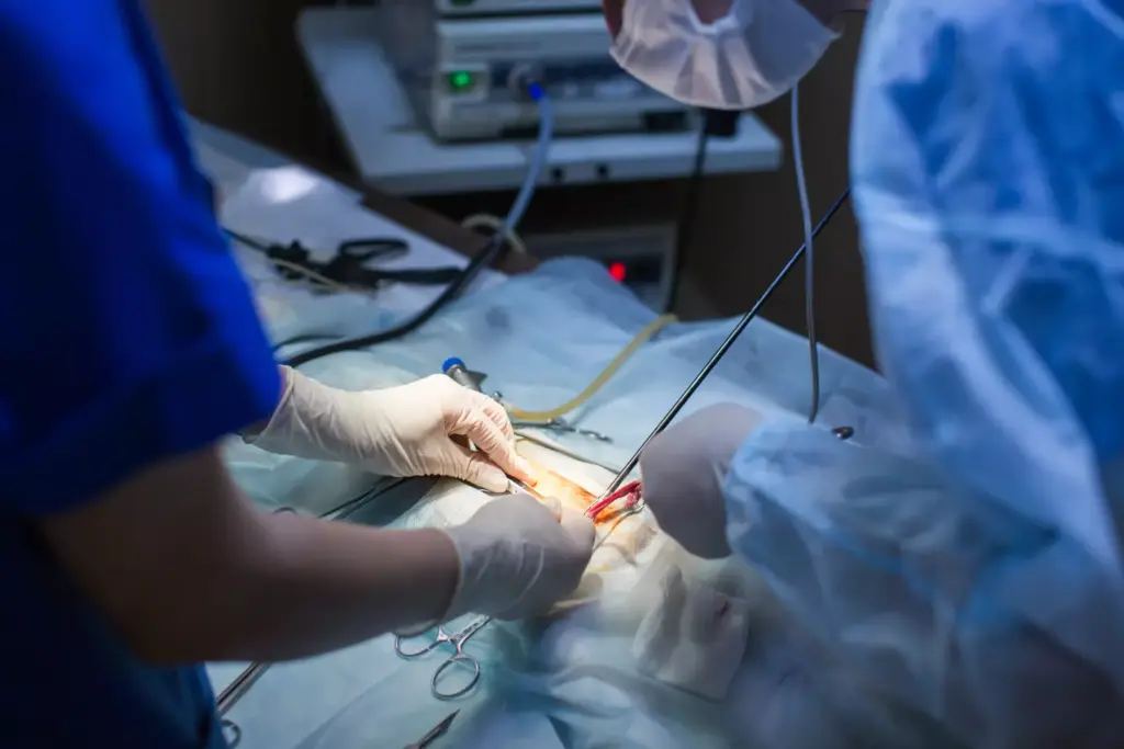 Types of Heart Bypass Procedures and Techniques