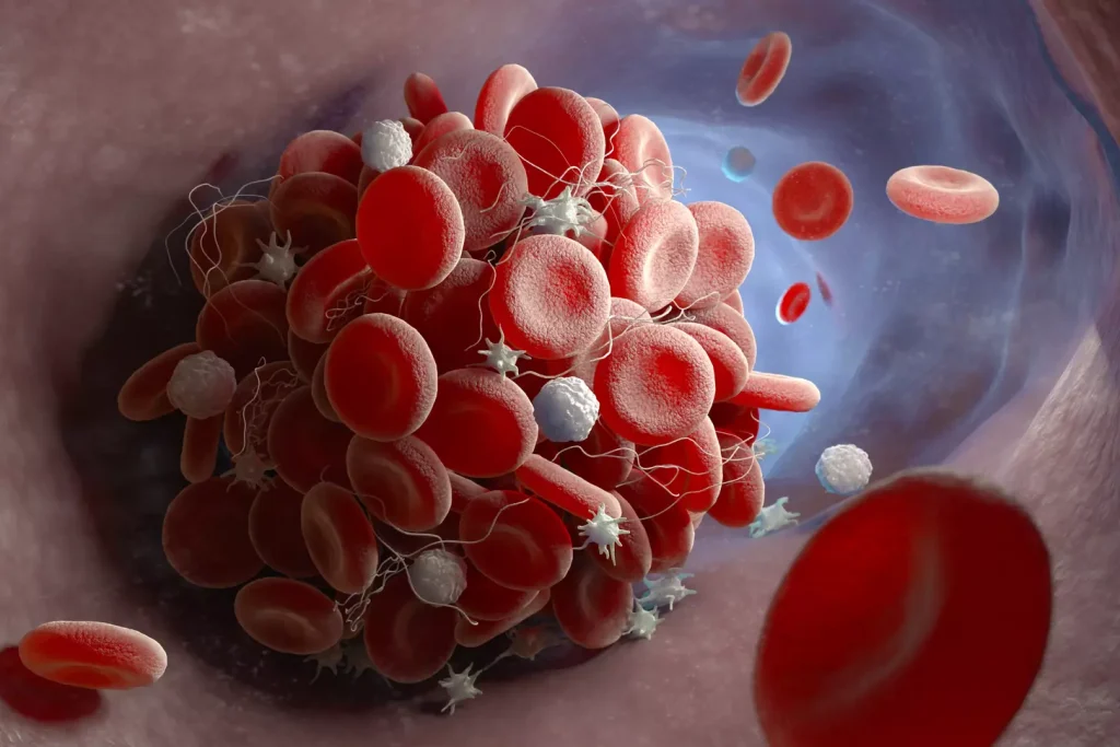Understanding Blood Cancer