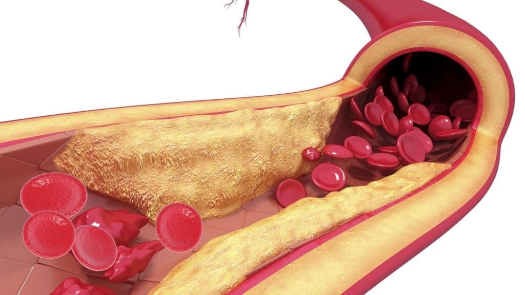 Understanding Blood Vessels