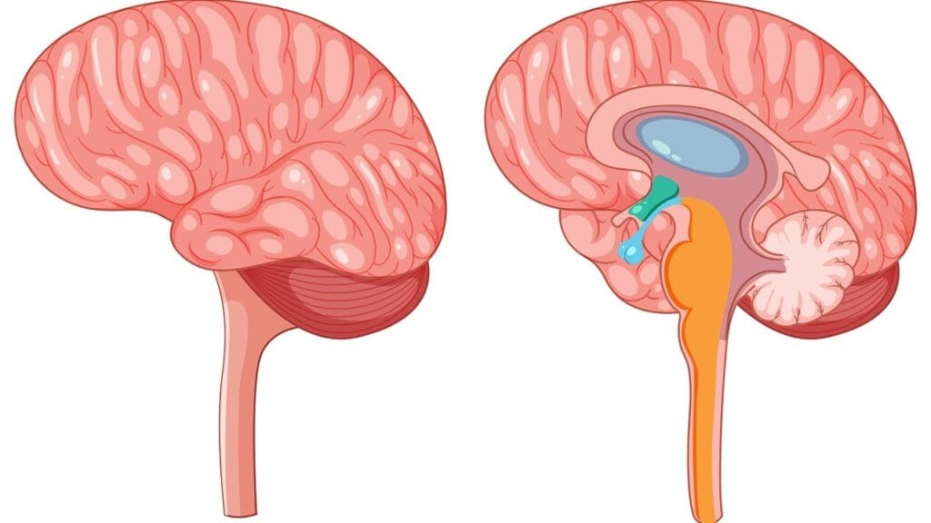 Understanding Brain Surgery