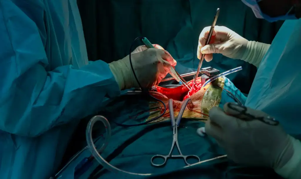 Understanding Cardiac Surgical Procedures