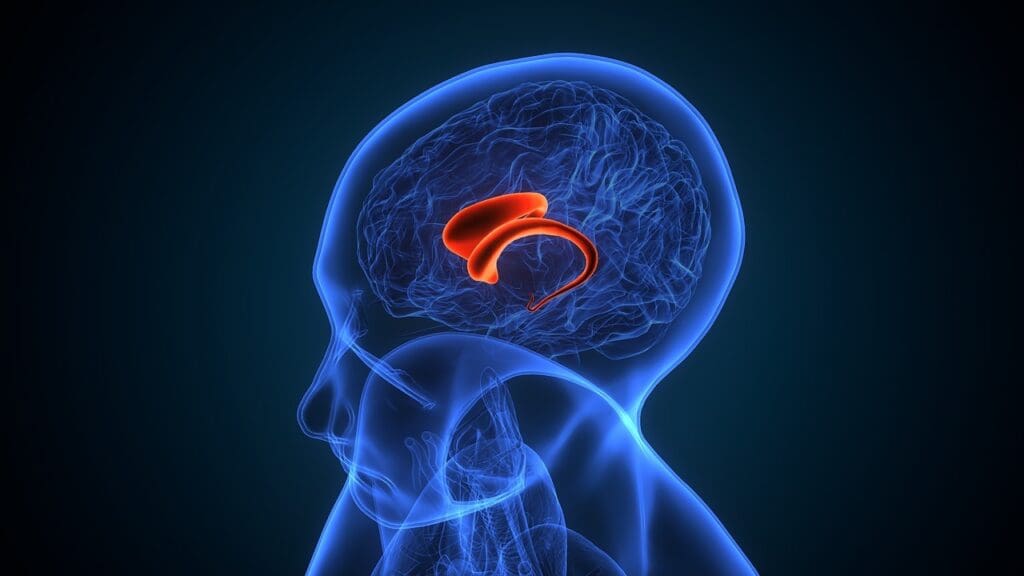 What Does a Shunt Look Like