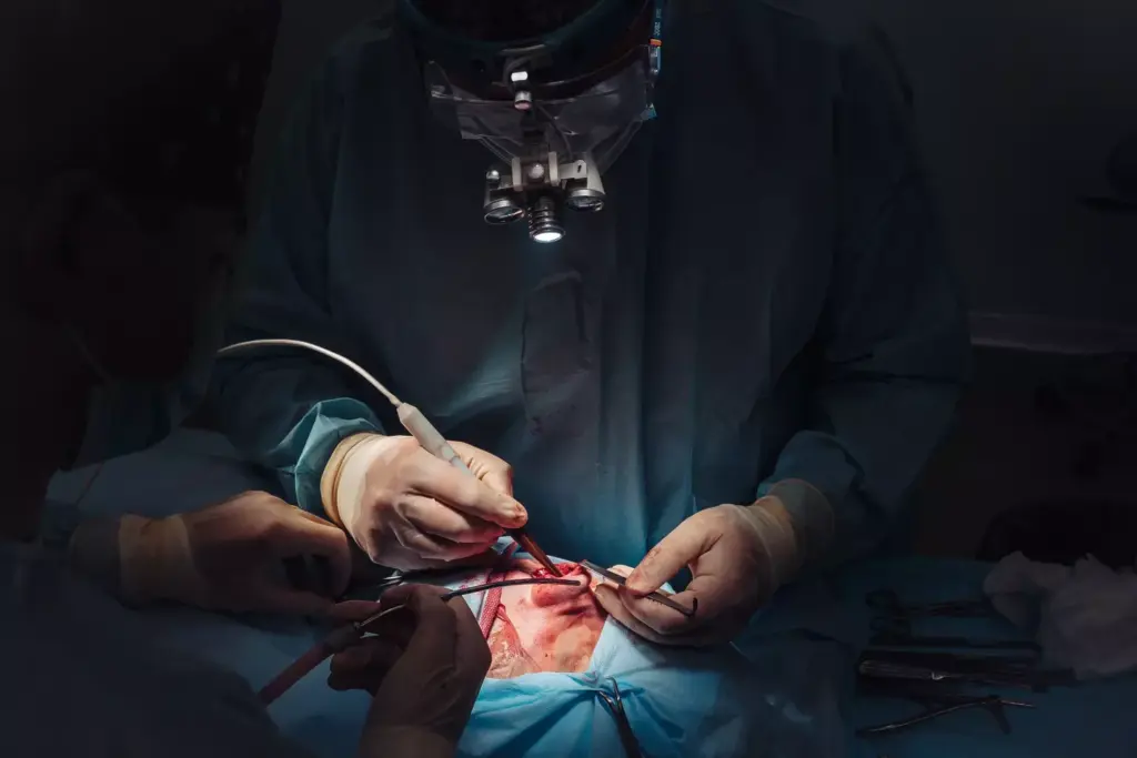 What Is Coronary Artery Bypass Graft (CABG) Surgery?
