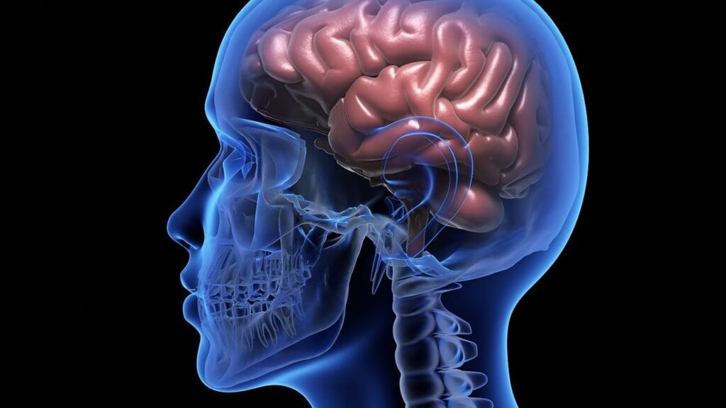 What Is a Mass on Brain Stem