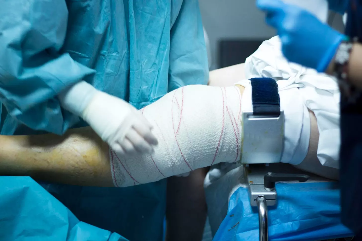acl surgery