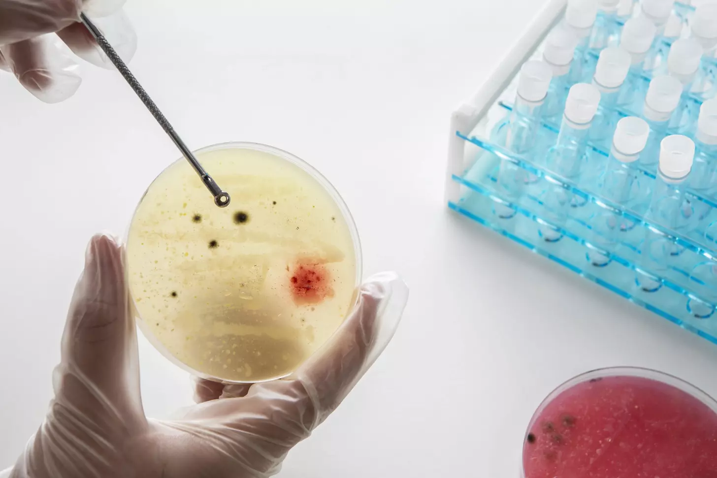 allogeneic stem cell transplant