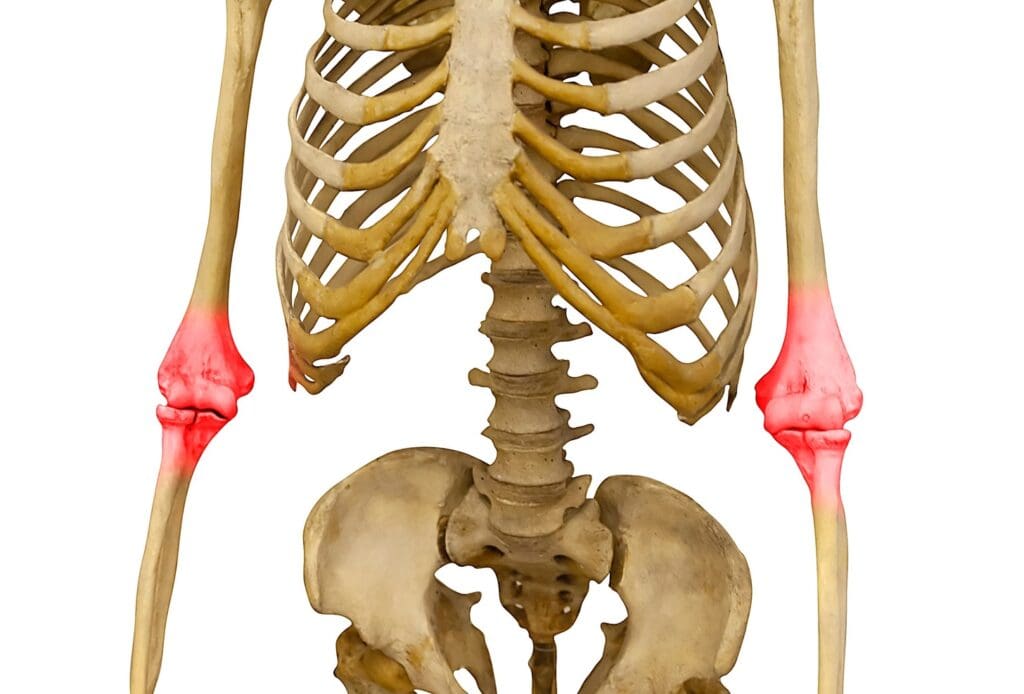 anatomical view of bone metastases