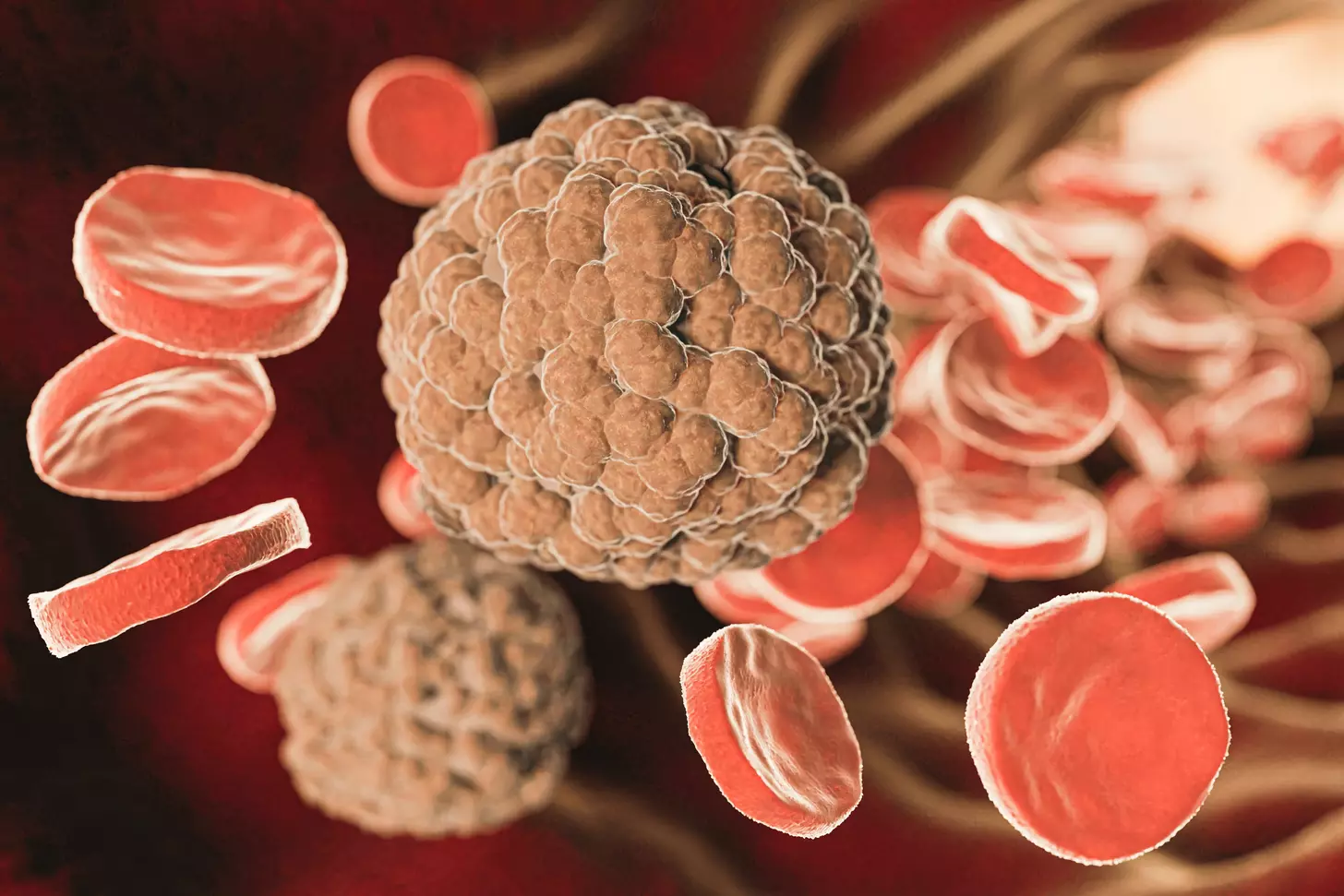 aneurysm vs blood clot