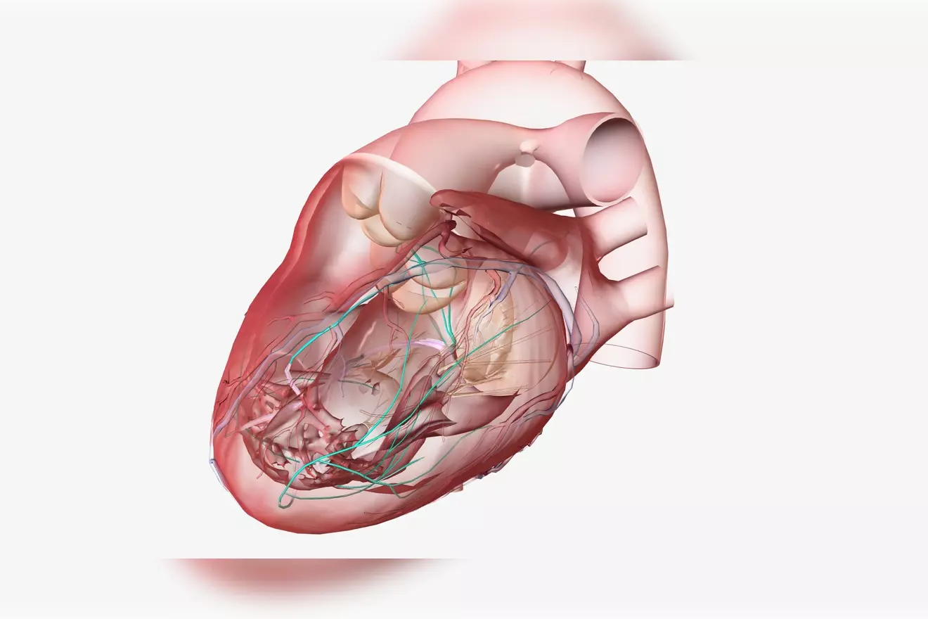 aorta aneurysm sizes