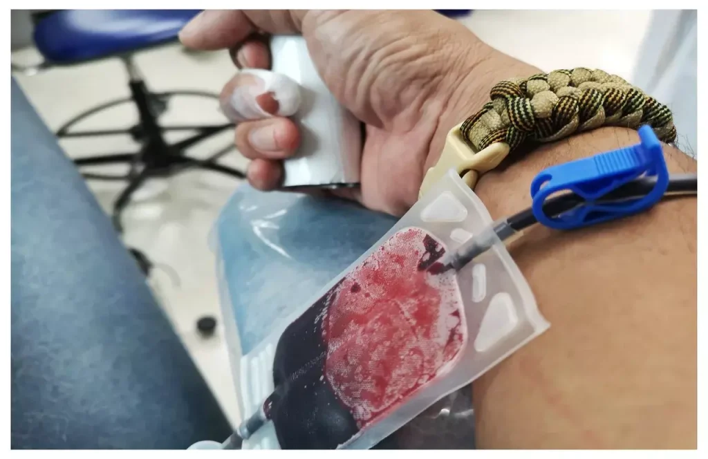 aplastic anemia blood work