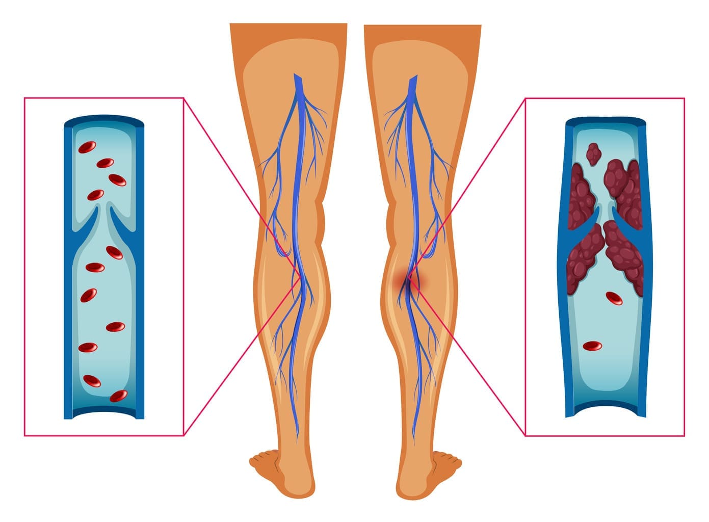 arteries behind the knee