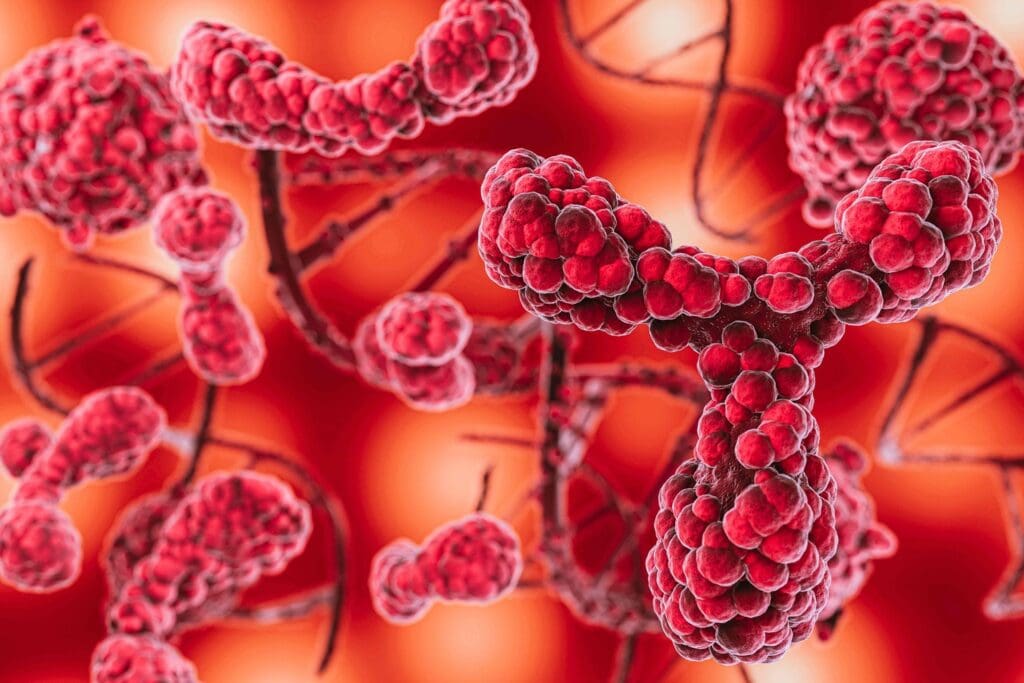 arteriovenous malformation, depicted as a complex network of enlarged, tangled blood vessels