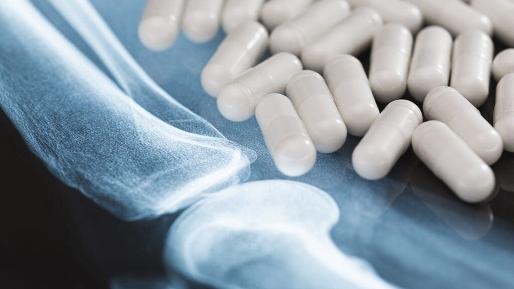 arthritis pain medication effectiveness
