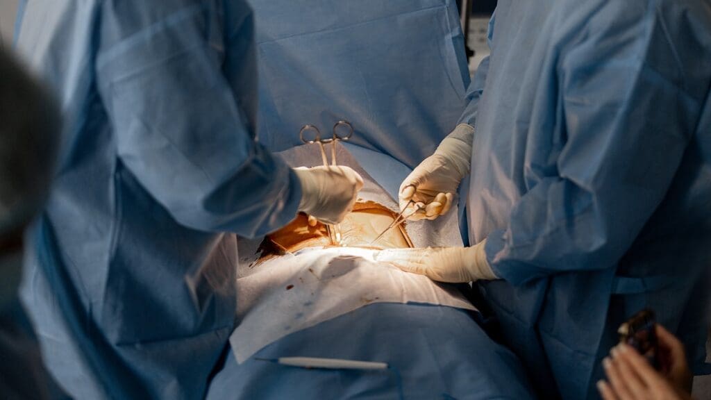 arthroscopic surgery