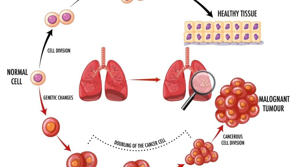 atherosclerosis disease of age evolution