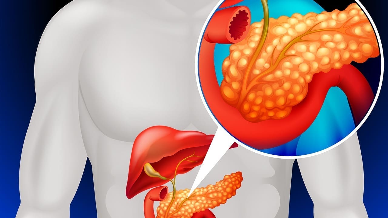 atherosclerosis of the abdominal aorta