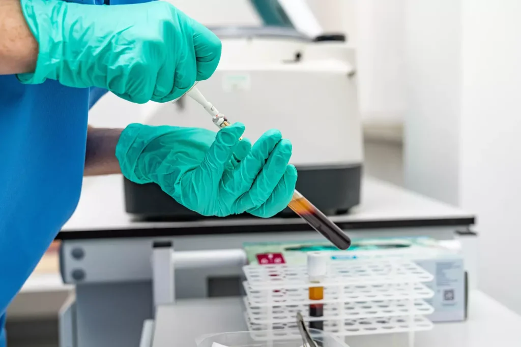  autologous hematopoietic stem cell transplant process