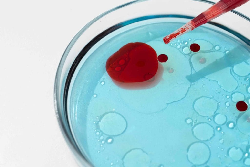 autologous hematopoietic stem cell transplantation