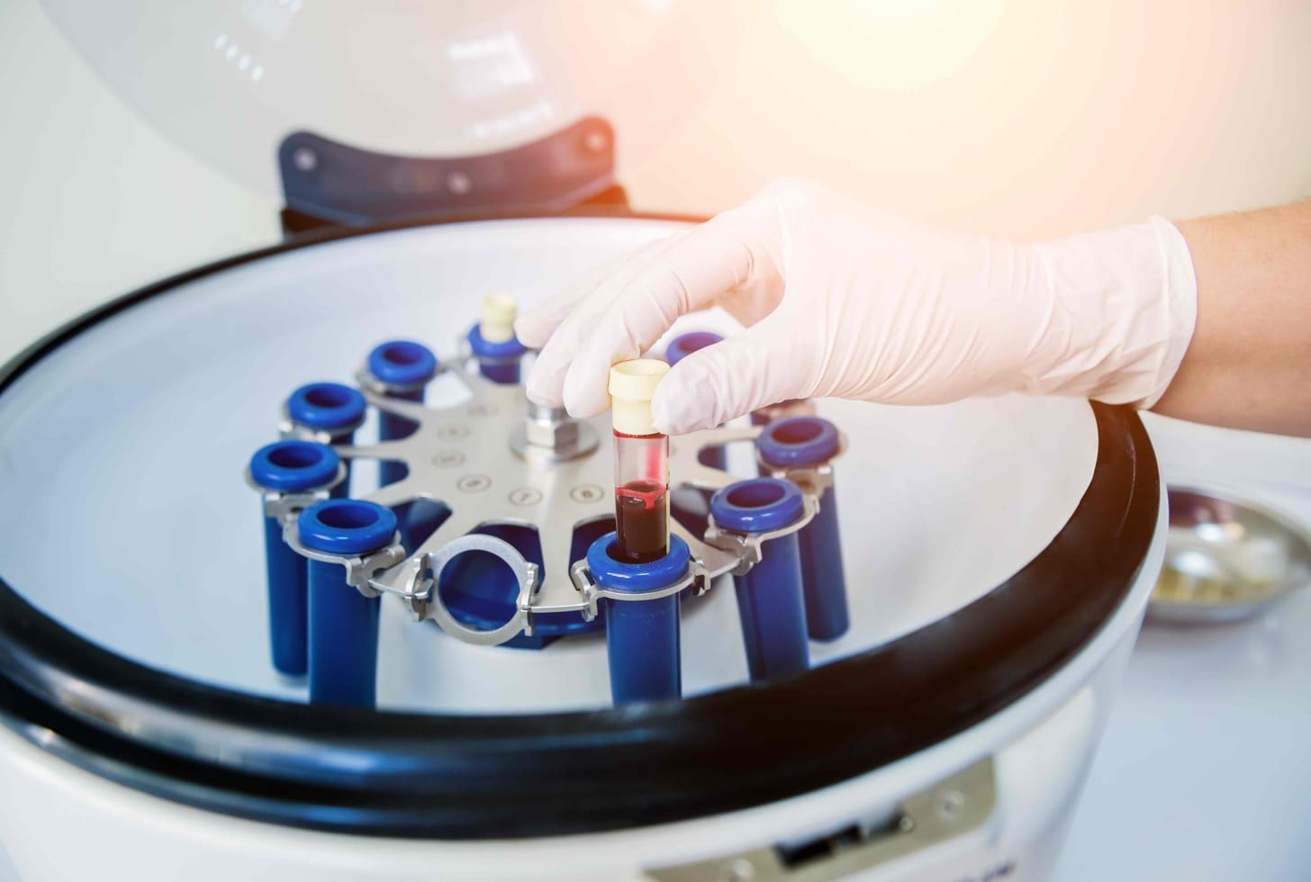 autologous stem cell transplant process