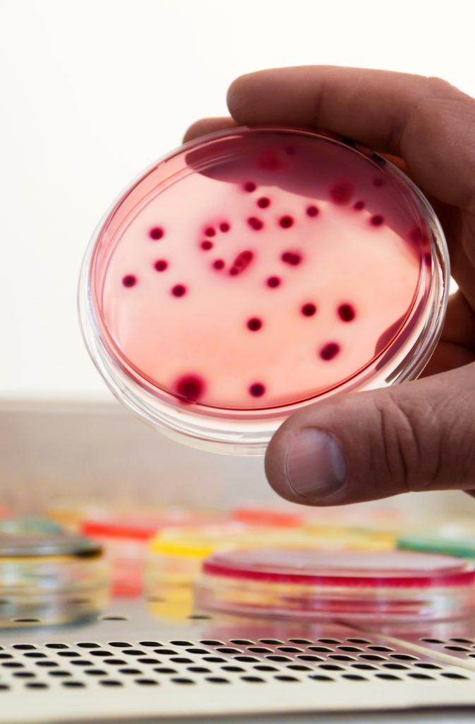 bacterial colonies culture differential selective media biotechnology health LIV Hospital