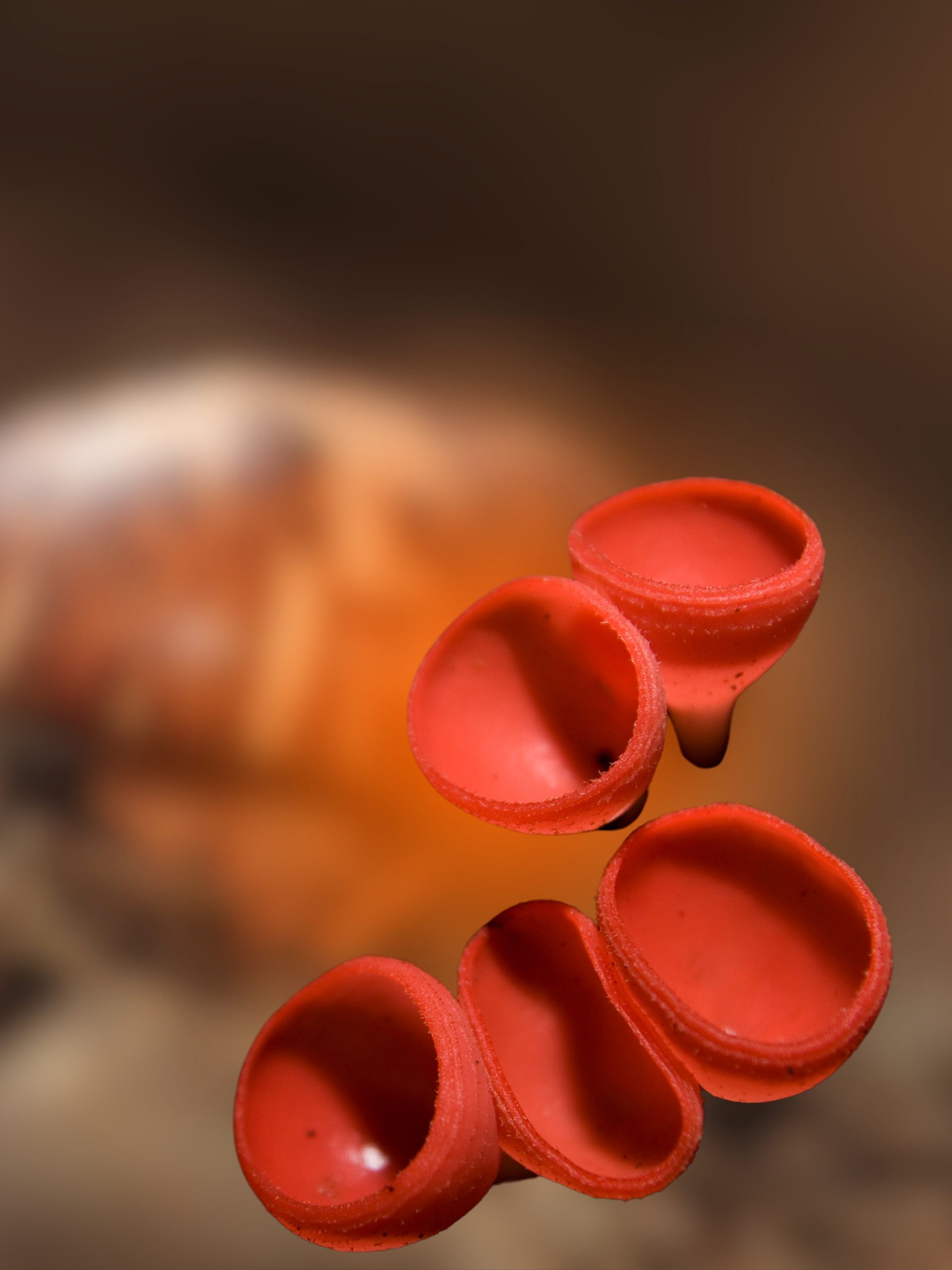 Who is most likely to get hemophilia