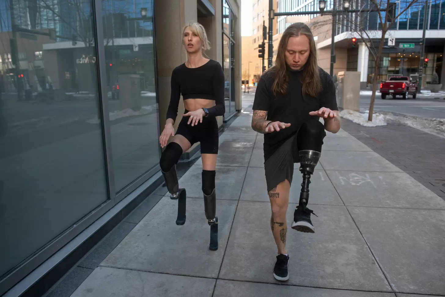 bilateral hip prosthesis