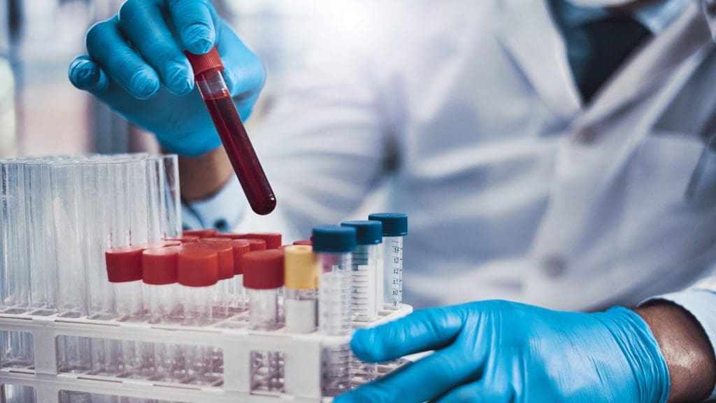 blood sample analysis