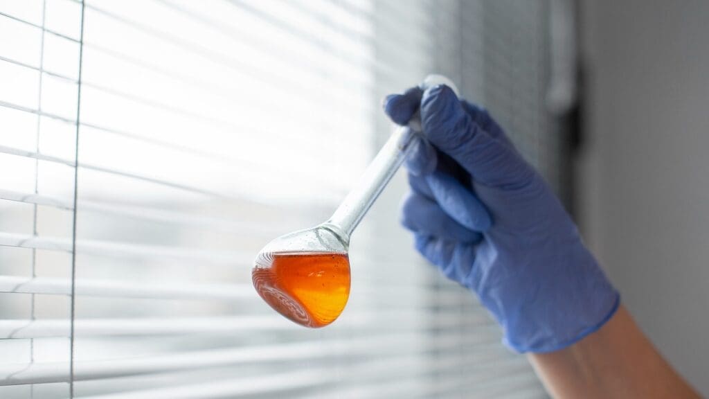 bloody urine after prostatectomy