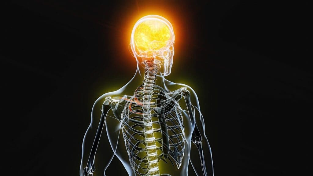 brain on fire disease