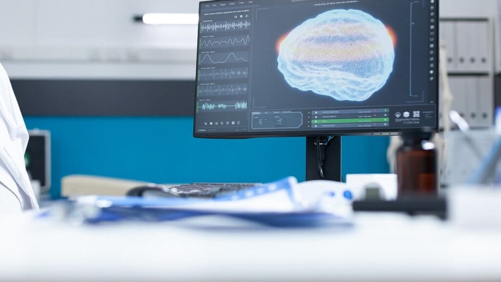 brain stem glioma life expectancy