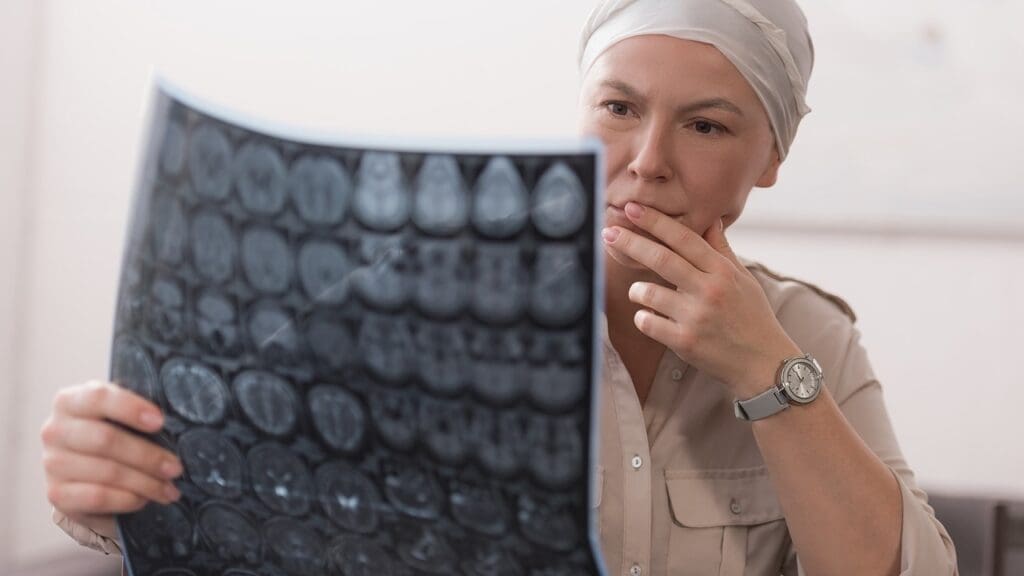 brain swelling causes