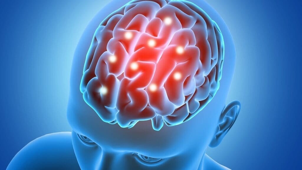 brain tumor and memory loss