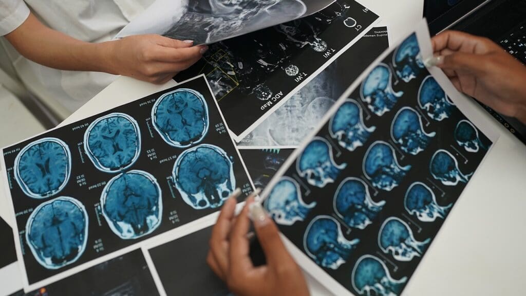 brain tumor classification