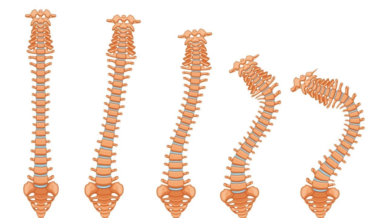 c3 and c4 vertebrae