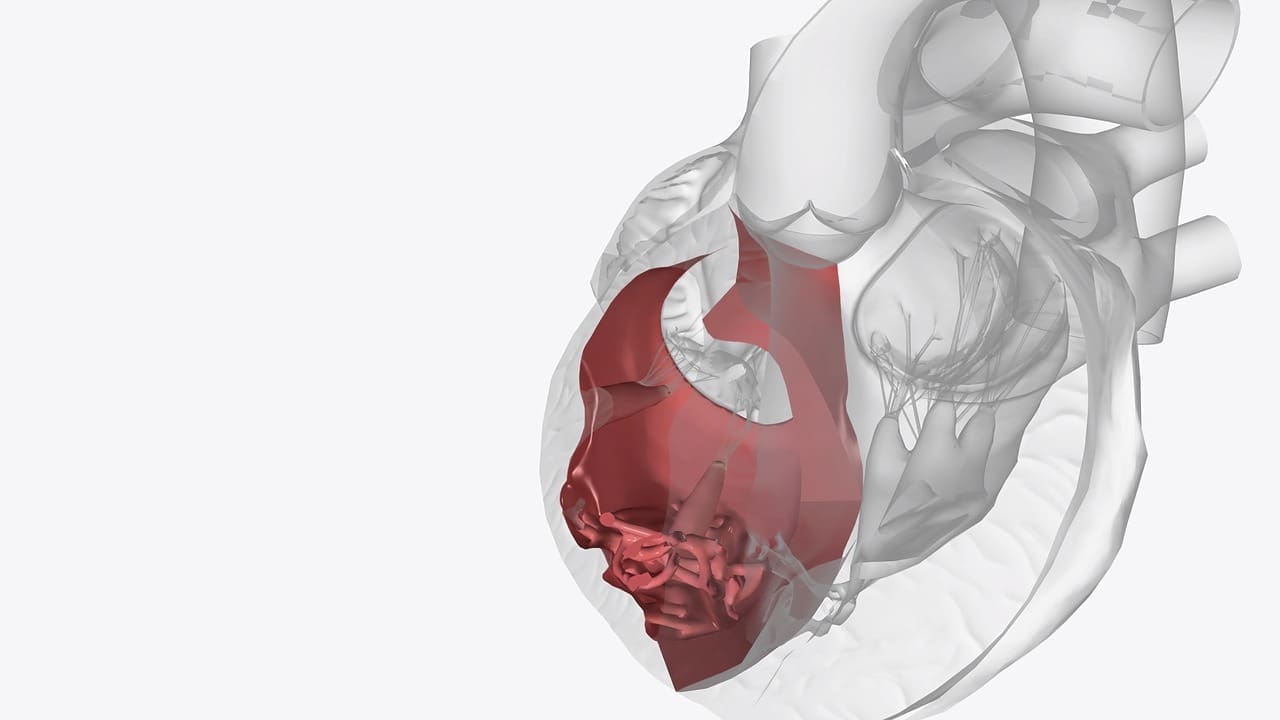 calcification of heart valves