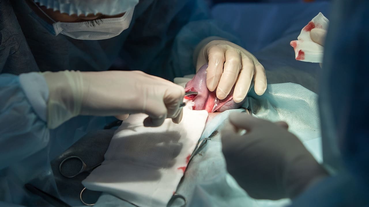 can an aneurysm be removed