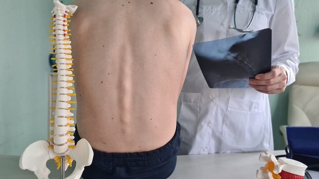 cancer of spine life expectancy