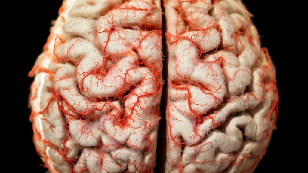 Cerebral Cysts: 9 Key Symptoms, Risks, and MRI Findings to Know 1 Cerebral Cysts: 9 Key Symptoms, Risks, and MRI Findings to Know