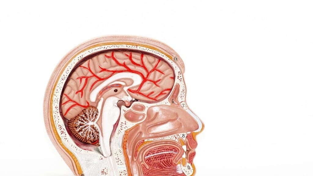 cerebral edema definition